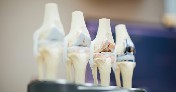 Physical Therapy